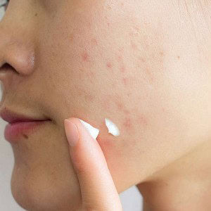 SKIN1004 Madagascar Centella Tea-Trica Spot Cream 20ml