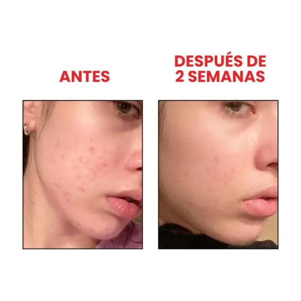 ANUA Niacinamide 10% + TXA 4% Serum 30ml