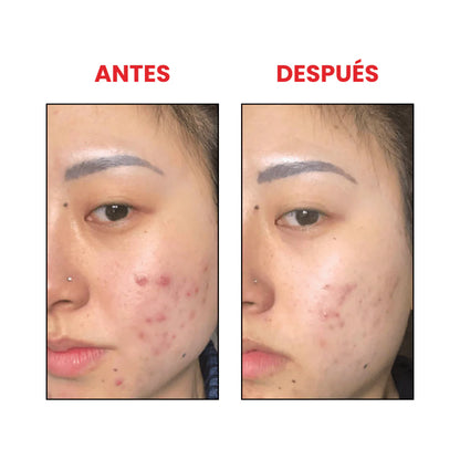 COSRX Salicylic Acid Daily Gentle Cleanser 150ml